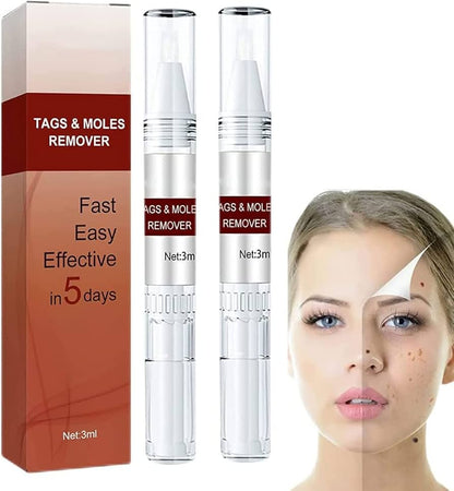 Professional Skin Tag & Mole Removal Device – Flawless Skin At Home